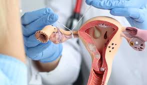 Considering a Tubal Reversal Near You? Here’s What You Should Know Considering a Tubal Reversal Near You? Here’s What You Should Know