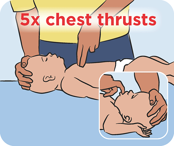 child Choking Protocol: Back Blows and Chest Thrusts