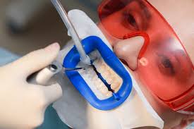 The Importance of Choosing the Right Dentist for Long-Term Oral Health